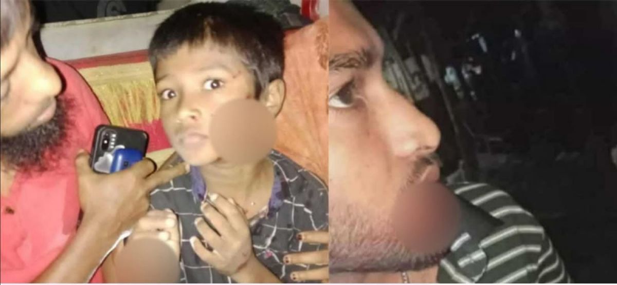 কুমিল্লা দেবীদ্বারে শিয়ালের কামড়ে শিশুসহ আহত-৭