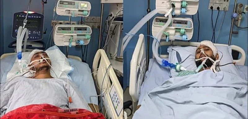 জ্ঞান ফেরেনি সায়েমের, মামুনের খুলির ঠাঁই ফ্রিজে