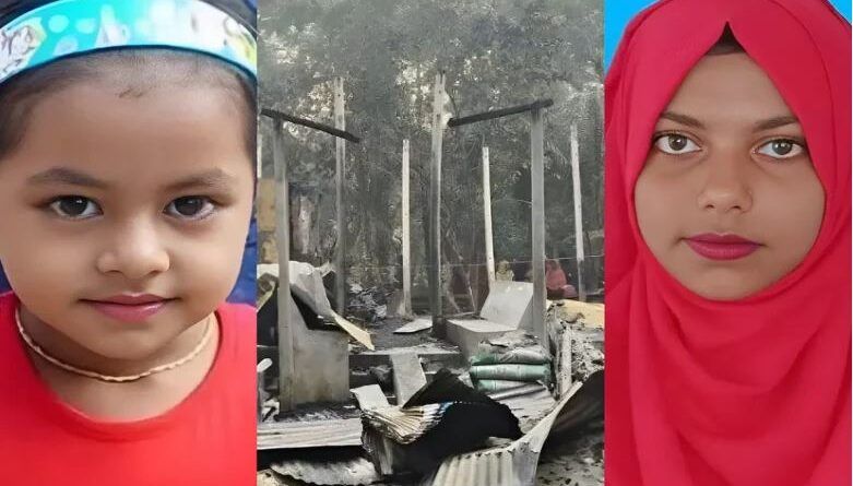 ছোট বোনের পর মারা গেল ৯০ শতাংশ দগ্ধ স্মৃতি