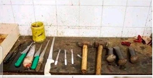 দেশে আধুনিক ফরেনসিক বিভাগ দরকার