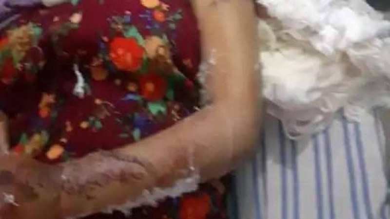 প্রেমে রাজি না হওয়ায় স্তন কেটে হত্যার চেষ্টা