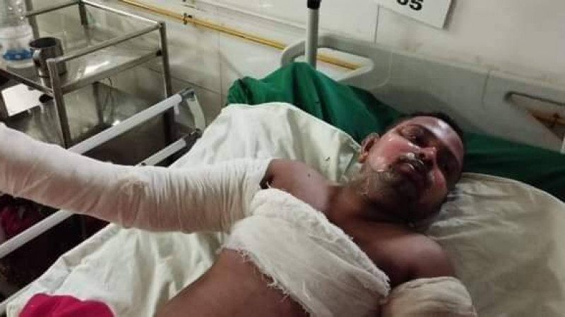 দাহ্য ক্যামিক্যালে আগুন লেগে পুড়ে গেছে ৪ শ্রমিক