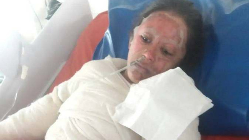 চলেই গেলো বিদ্যুতে দগ্ধ ফাহিমা