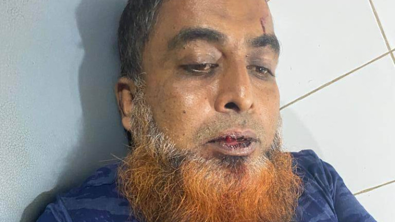 দোহারে পু‌লিশের উপ‌স্থিতি‌তে শালিশিদের উপর কি‌শোর গ‌্যাং‌য়ের  হামলা